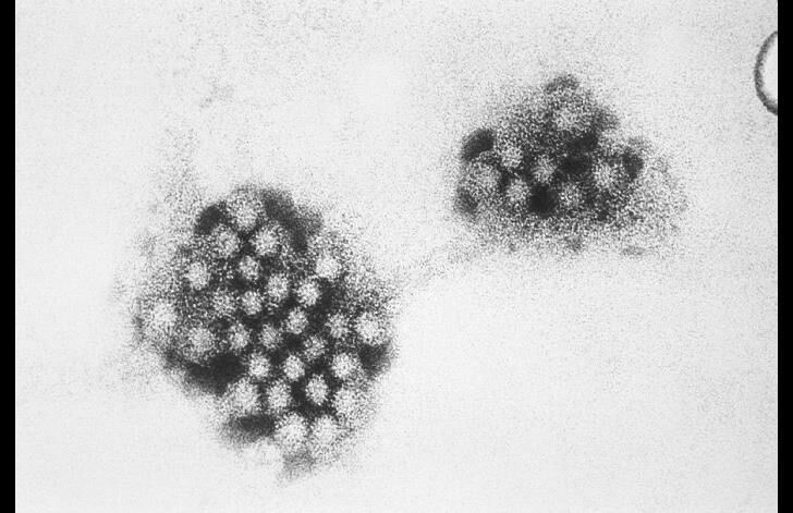 Norovirus
